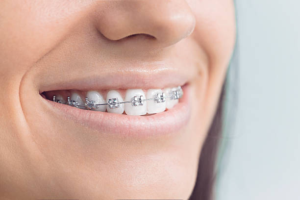 Best Dental Inlays and Onlays  in Rice Lake, WI